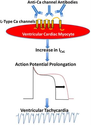 Autoimmune Calcium Channelopathies and Cardiac Electrical Abnormalities